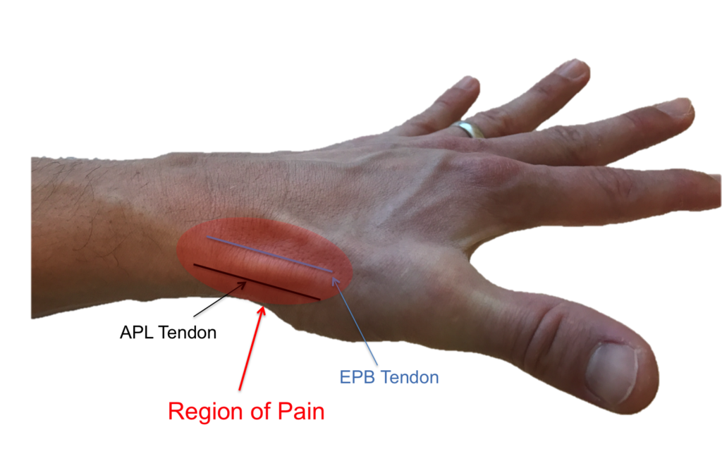 wrist pain occurs at base of thumb